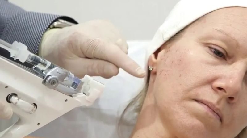 Skinbooster — soin chez Belle Clinique Esthetique